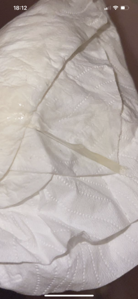 Is this part of my mucus plug