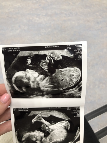 Nub theory
