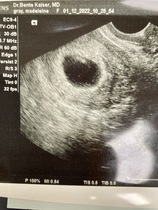 Due September 2022 - Thread #2
