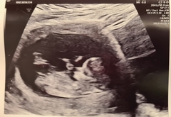 Due August 2022