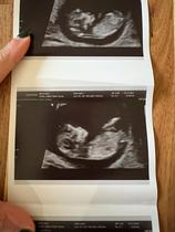 Thoughts appreciated - girl or boy?