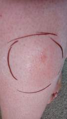 What was this bite? Posting for traffic