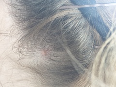 Is this a mole? Shall I leave it alone?
