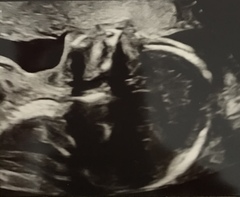 Due June 2022 (thread seven!)