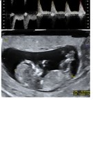 Boy nub that could maybe be a girl? 🙄 Yes. Im going crazy. Anyone in same situation?