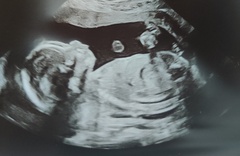 Just for fun- guesses please boy or girl