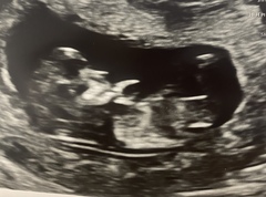 12 weeks gender predictions please