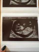 Thoughts appreciated - girl or boy?