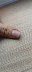 AIBU to book a drs appointment for this (with pics))