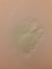 To ask what this is? (Pics included)
