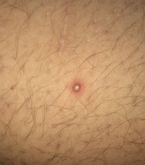 I found these on DP’s back last night