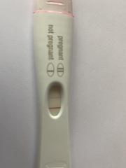 Post IVF line eyes