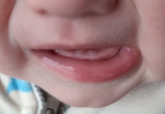 Sleep regression. Anyone else want to join!? Sleepless mums!