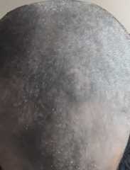 To shave my head