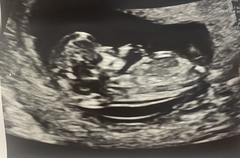 12 weeks gender predictions please