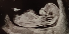 Just for fun- guesses please boy or girl