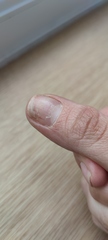 AIBU to book a drs appointment for this (with pics))
