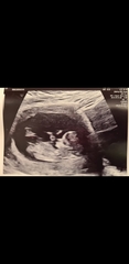Due August 2022