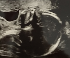 Due June 2022 (thread seven!)