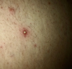 I found these on DP’s back last night