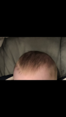 newborn hair turning orange?