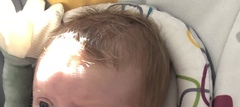 newborn hair turning orange?