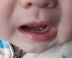 Sleep regression. Anyone else want to join!? Sleepless mums!