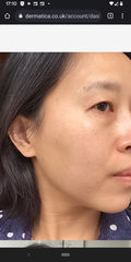 Has anyone had a big Makeover / look very different post 40