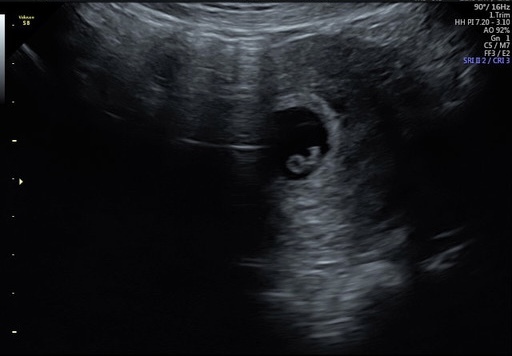 Due October 2022