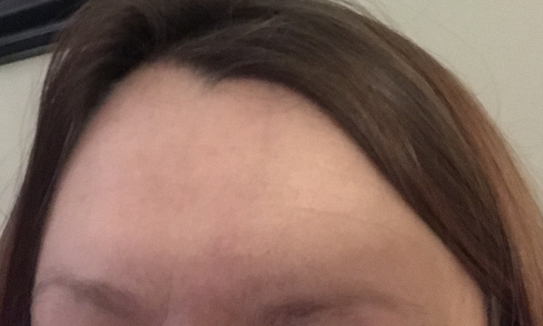 Forehead skincare