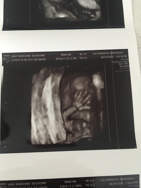 4D scan worth it at 19w?