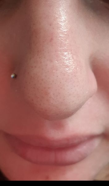 Please help me with these damn pores!