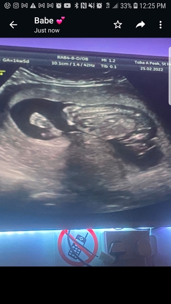 Gender of baby