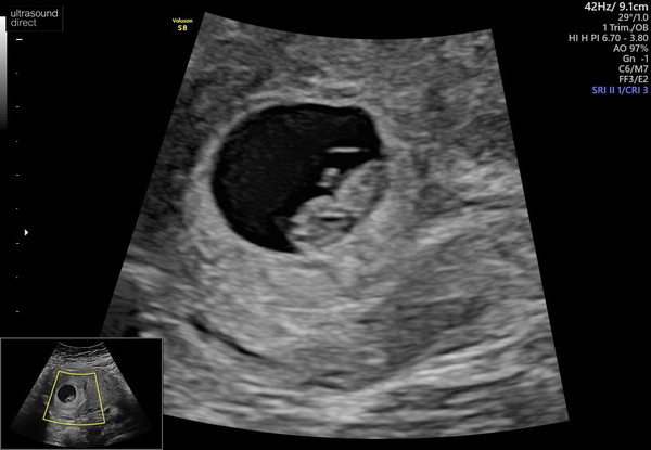 Due October 2022 thread #2 ... the first trimester continues!