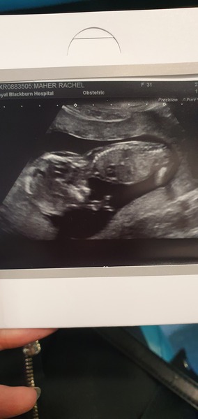 14+2 scan :) gender guesses