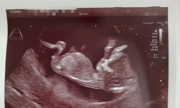 Due July 2022 (thread 3)