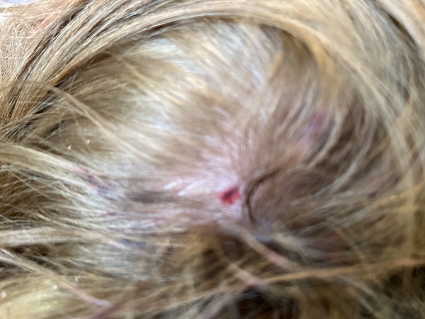 6 year old cut on head - Am i right to just watch her ?