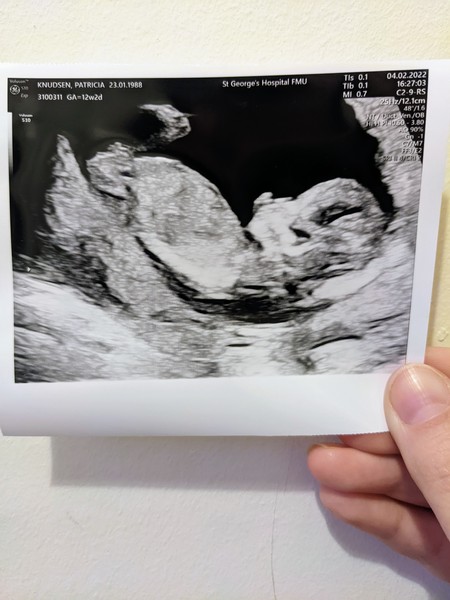 Minsters Side Car - A few more bumps have now turned into babies -  Thread 6