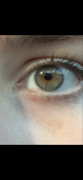 What is my eye colour?