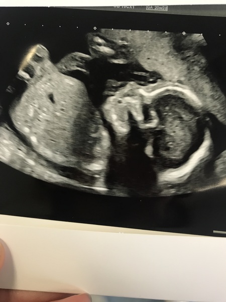 Girl or boy guesses