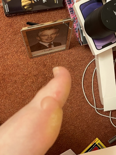 What to do about big blister