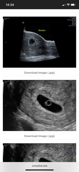 Early scan sent me into a head spin - advice welcome