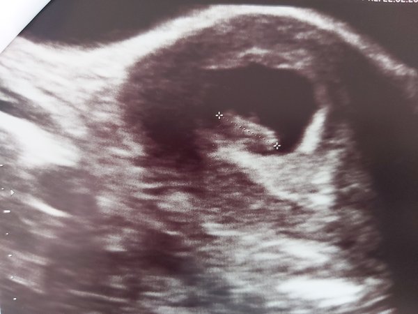 Due October 2022