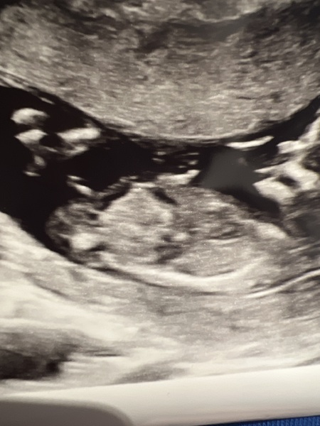 12 week Nub Theory