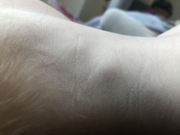 Lump in son’s neck