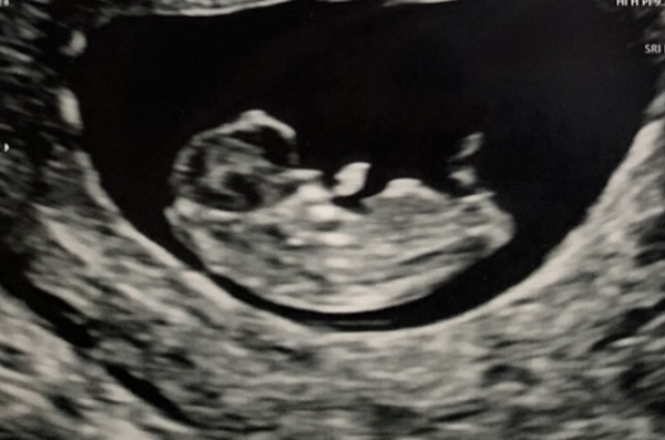 Due September 2022 - Thread #3