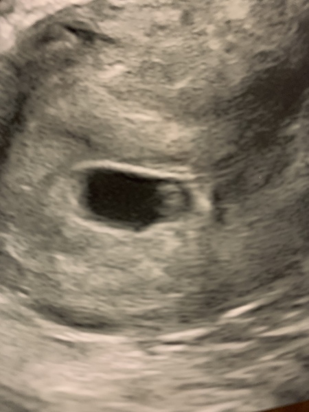 Ttc after miscarriage thread 4 🌈💞✨🤞