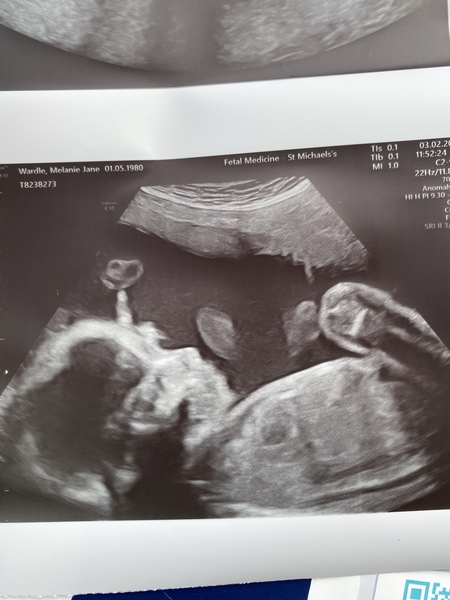 Hello ladies 40+ and Pregnant! 😀
