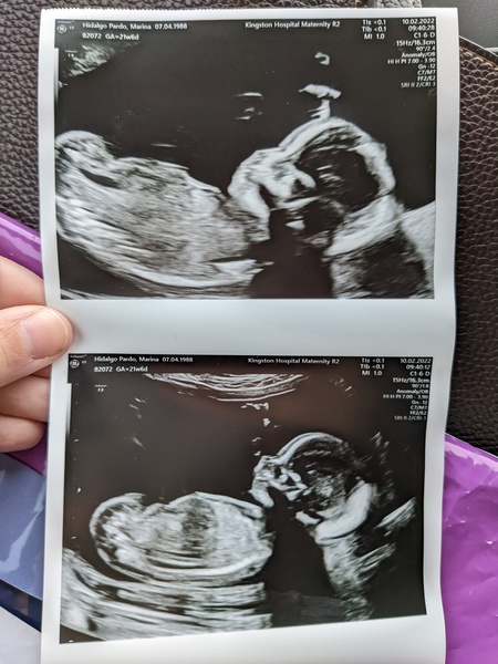 Due June 2022 (thread seven!)