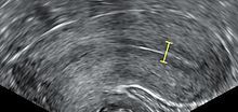 IVF/FET Jan/Feb/March No2 2022